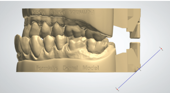 dental formlabs 5