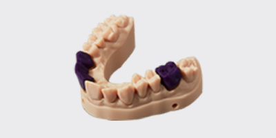 Implantes dentales impresos en 3D