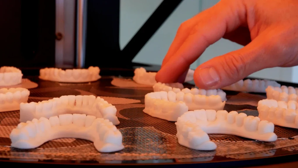 Alineadores dentales en 3D