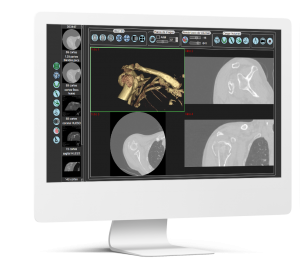 Sapphire5D software radiología impresión 3D Sicnova