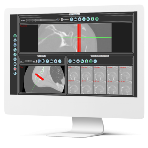 sapphire5d-software-radiologia-impresion-3d-b.png